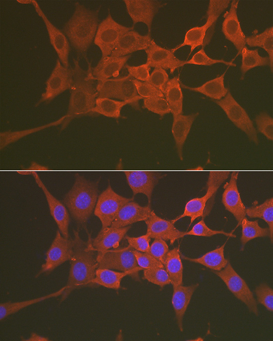 Immunofluorescence analysis of NIH/3T3 cells using Caspase-3 p17 Polyclonal Antibody at dilution of 1:50 (40x lens). Blue: DAPI for nuclear staining.