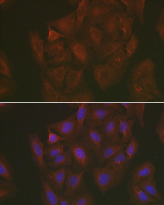 Immunofluorescence analysis of U2OS cells using Caspase-3 p17 Polyclonal Antibody at dilution of 1:50 (40x lens). Blue: DAPI for nuclear staining.