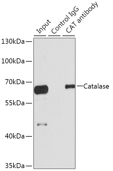 Immunoprecipitation analysis of 100ug extracts of HepG2 cells using 3ug Catalase Polyclonal Antibody. Western blot was performed from the immunoprecipitate using Catalase Polyclonal Antibody at a dilution of 1:1000.