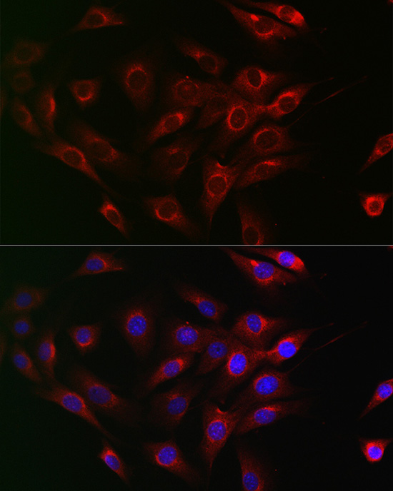 Immunofluorescence analysis of NIH/3T3 cells using [KO Validated] Beclin 1 Polyclonal Antibody at dilution of 1:200 (40x lens). Blue: DAPI for nuclear staining.