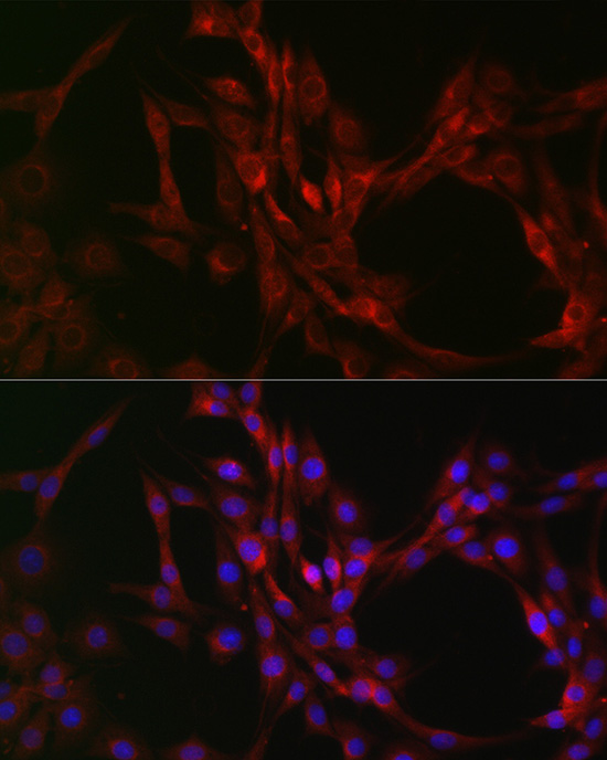 Immunofluorescence analysis of PC-12 cells using [KO Validated] Beclin 1 Polyclonal Antibody at dilution of 1:200 (40x lens). Blue: DAPI for nuclear staining.