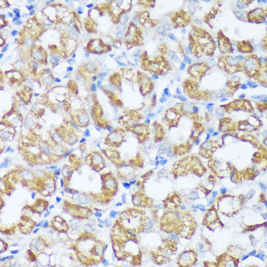 Immunohistochemistry of paraffin-embedded human stomach using Beclin 1 Polyclonal Antibody at dilution of 1:100 (40x lens).Perform microwave antigen retrieval with 10 mM PBS buffer pH 7.2 before commencing with IHC staining protocol.