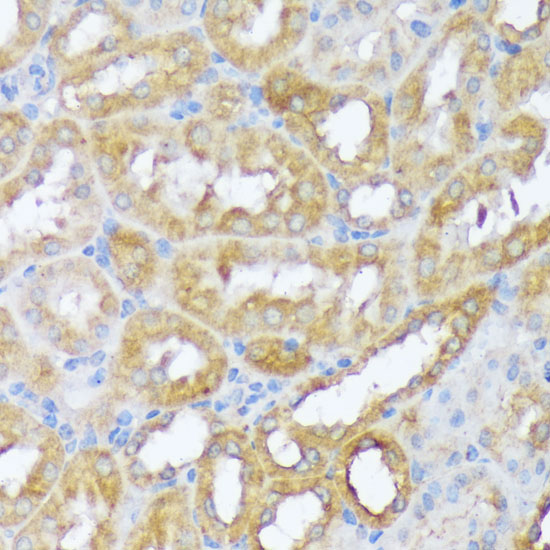 Immunohistochemistry of paraffin-embedded mouse kidney using Beclin 1 Polyclonal Antibody at dilution of 1:100 (40x lens).Perform microwave antigen retrieval with 10 mM PBS buffer pH 7.2 before commencing with IHC staining protocol.