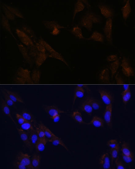 Immunofluorescence analysis of C6 cells using CD133 Polyclonal Antibody at dilution of 1:100. Blue: DAPI for nuclear staining.