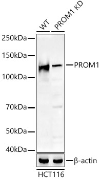 Western blot analysis of extracts from wild type(WT) and PROM1 knockdown (KD) HCT116 cells using PROM1 Polyclonal Antibody at 1:400 dilution.