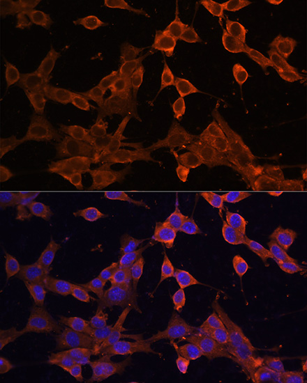 Immunofluorescence analysis of NIH/3T3 cells using SQSTM1/p62 Polyclonal Antibody at dilution of 1:100. Blue: DAPI for nuclear staining.