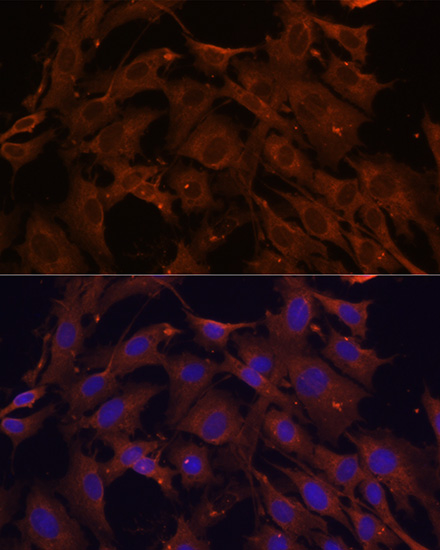 Immunofluorescence analysis of C6 cells using SQSTM1/p62 Polyclonal Antibody at dilution of 1:100. Blue: DAPI for nuclear staining.