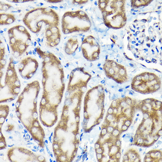 Immunohistochemistry of paraffin-embedded Mouse kidney using SQSTM1/p62 Polyclonal Antibody at dilution of 1:100 (40x lens).Perform high pressure antigen retrieval with 10 mM citrate buffer pH 6.0 before commencing with IHC staining protocol.