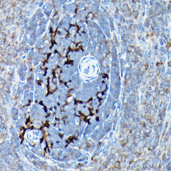 Immunohistochemistry of paraffin-embedded Rat spleen using SQSTM1/p62 Polyclonal Antibody at dilution of 1:100 (40x lens).Perform high pressure antigen retrieval with 10 mM citrate buffer pH 6.0 before commencing with IHC staining protocol.