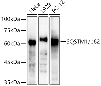 Western blot analysis of extracts of various cell lines using SQSTM1/p62 Polyclonal Antibody at 1:4000 dilution.