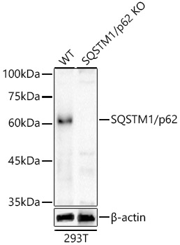 Western blot analysis of extracts from wild type(WT) and SQSTM1/p62 knockout (KO) 293T cells using SQSTM1/p62 Polyclonal Antibody at 1:4000 dilution.