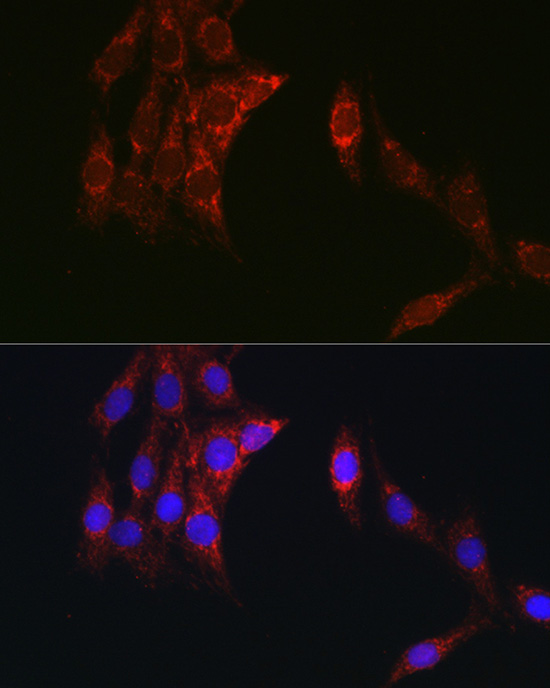 Immunofluorescence analysis of C6 cells using TOM20 Polyclonal Antibody at dilution of 1:100 (40x lens). Blue: DAPI for nuclear staining.