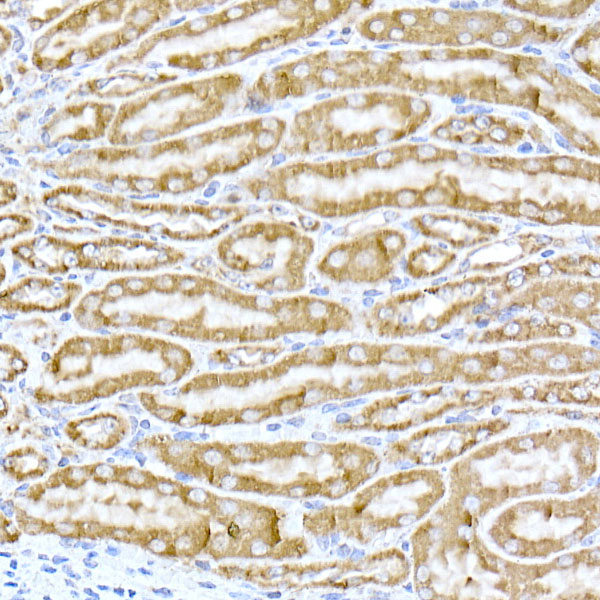 Immunohistochemistry of paraffin-embedded mouse kidney using TOM20 Polyclonal Antibody at dilution of 1:50 (40x lens).Perform high pressure antigen retrieval with 10 mM citrate buffer pH 6.0 before commencing with IHC staining protocol.