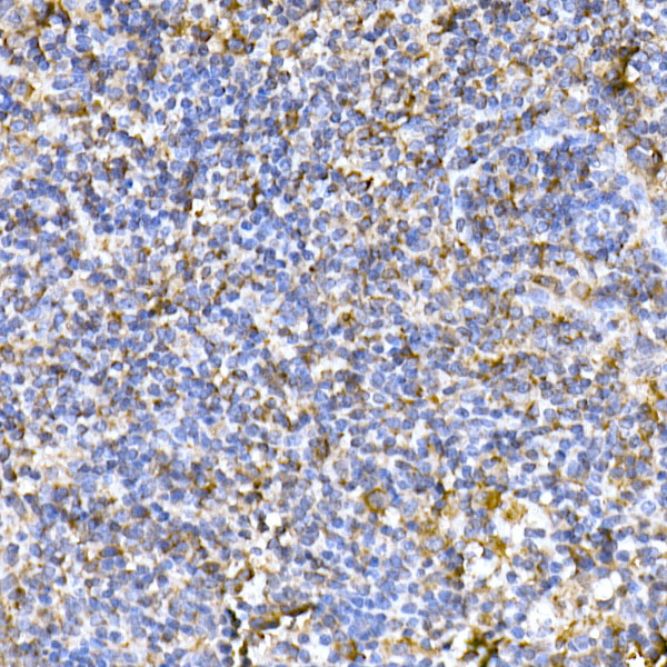 Immunohistochemistry of paraffin-embedded mouse spleen using TOM20 Polyclonal Antibody at dilution of 1:50 (40x lens).Perform high pressure antigen retrieval with 10 mM citrate buffer pH 6.0 before commencing with IHC staining protocol.