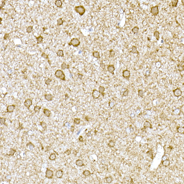 Immunohistochemistry of paraffin-embedded rat brain using TOM20 Polyclonal Antibody at dilution of 1:50 (40x lens).Perform high pressure antigen retrieval with 10 mM citrate buffer pH 6.0 before commencing with IHC staining protocol.