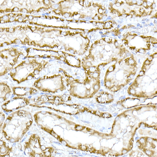 Immunohistochemistry of paraffin-embedded rat kidney using TOM20 Polyclonal Antibody at dilution of 1:50 (40x lens).Perform high pressure antigen retrieval with 10 mM citrate buffer pH 6.0 before commencing with IHC staining protocol.