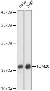 Western blot analysis of extracts of various cell lines using TOM20 Polyclonal Antibody at 1:1000 dilution.