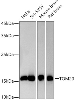 Western blot analysis of extracts of various cell lines using [KD Validated] TOM20 Polyclonal Antibody at 1:1000 dilution.