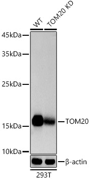 Western blot analysis of extracts from wild type(WT) and TOM20 knockdown (KD) 293T cells using (KD Validated)TOM20 Polyclonal Antibody at 1:1000 dilution.