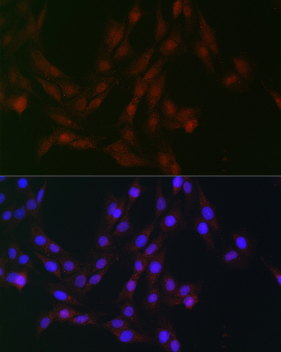 Immunofluorescence analysis of C6 cells using CDK1 Polyclonal Antibody at dilution of 1:100 (40x lens). Blue: DAPI for nuclear staining.