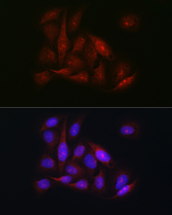 Immunofluorescence analysis of U2OS cells using CDK1 Polyclonal Antibody at dilution of 1:100 (40x lens). Blue: DAPI for nuclear staining.