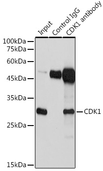 Immunoprecipitation analysis of 600ug extracts of Jurkat cells using 3ug CDK1 Polyclonal Antibody. Western blot was performed from the immunoprecipitate using CDK1 Polyclonal Antibody at a dilution of 1:1000.