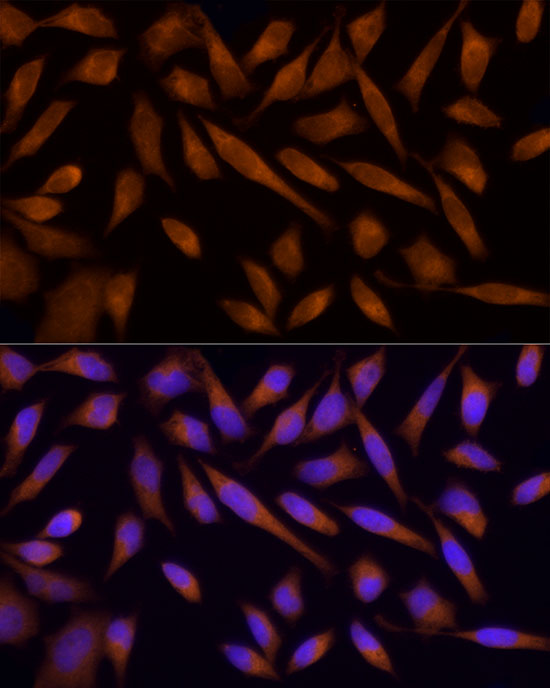 Immunofluorescence analysis of HeLa cells using AMPKα1 Polyclonal Antibody at dilution of 1:100 (40x lens). Blue: DAPI for nuclear staining.