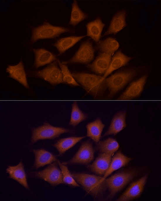 Immunofluorescence analysis of NIH/3T3 cells using AMPKα1 Polyclonal Antibody at dilution of 1:100 (40x lens). Blue: DAPI for nuclear staining.