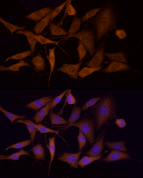 Immunofluorescence analysis of PC-12 cells using AMPKα1 Polyclonal Antibody at dilution of 1:100 (40x lens). Blue: DAPI for nuclear staining.