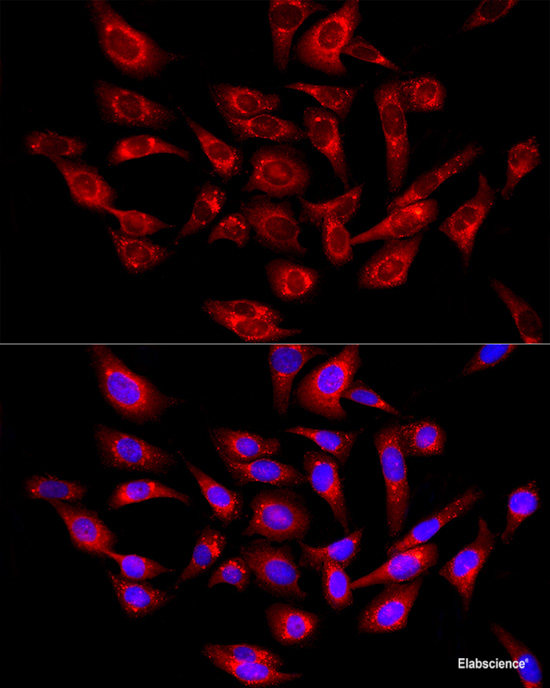 Immunofluorescence analysis of U2OS cells using PSAP Polyclonal Antibody at dilution of 1:100 (40x lens). Blue: DAPI for nuclear staining.