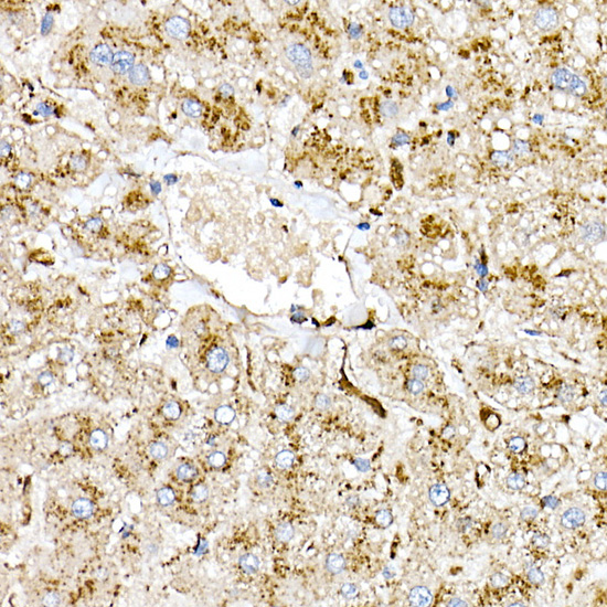 Immunohistochemistry of paraffin-embedded human liver using [KO Validated] PSAP Polyclonal Antibody at dilution of 1:50 (40x lens).Perform high pressure antigen retrieval with 10 mM citrate buffer pH 6.0 before commencing with IHC staining protocol.