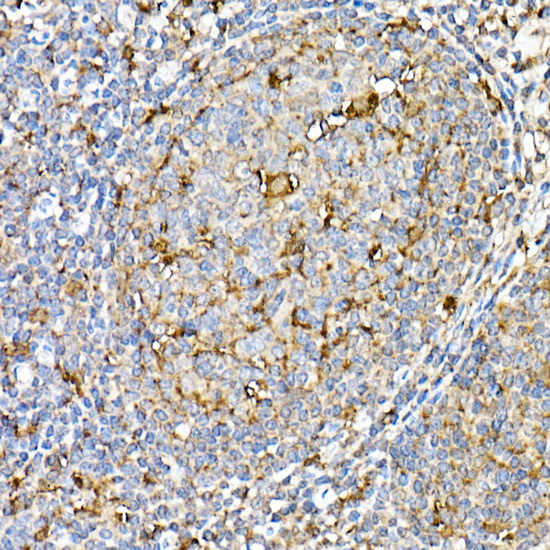 Immunohistochemistry of paraffin-embedded human tonsil using [KO Validated] PSAP Polyclonal Antibody at dilution of 1:50 (40x lens).Perform high pressure antigen retrieval with 10 mM citrate buffer pH 6.0 before commencing with IHC staining protocol.