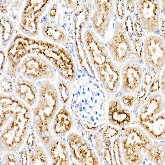 Immunohistochemistry of paraffin-embedded mouse kidney using [KO Validated] PSAP Polyclonal Antibody at dilution of 1:50 (40x lens).Perform high pressure antigen retrieval with 10 mM citrate buffer pH 6.0 before commencing with IHC staining protocol.