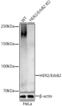 Western blot analysis of extracts from wild type(WT) and HER2/ErbB2 knockout (KO) HeLa cells using HER2/ErbB2 Polyclonal Antibody at 1:500 dilution.