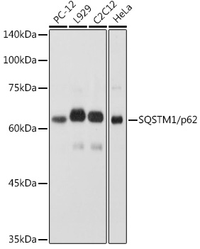 Western blot analysis of extracts of various cell lines using SQSTM1/p62 Polyclonal Antibody at 1:1000 dilution.