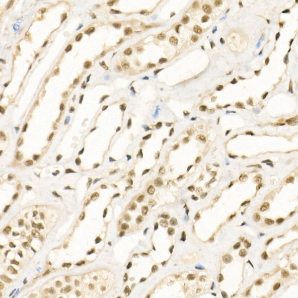 Immunohistochemistry of paraffin-embedded human kidney using KDM1A Polyclonal Antibody at dilution of 1:100 (40x lens).Perform high pressure antigen retrieval with 10 mM citrate buffer pH 6.0 before commencing with IHC staining protocol.