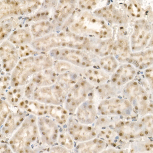 Immunohistochemistry of paraffin-embedded mouse kidney using KDM1A Polyclonal Antibody at dilution of 1:100 (40x lens).Perform high pressure antigen retrieval with 10 mM citrate buffer pH 6.0 before commencing with IHC staining protocol.