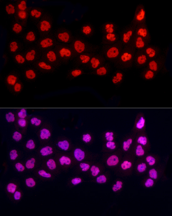 Immunofluorescence analysis of A-431 cells using HNRNPA2B1 Polyclonal Antibody at dilution of 1:50 (40x lens). Blue: DAPI for nuclear staining.