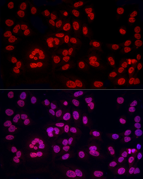 Immunofluorescence analysis of HeLa cells using HNRNPA2B1 Polyclonal Antibody at dilution of 1:50 (40x lens). Blue: DAPI for nuclear staining.