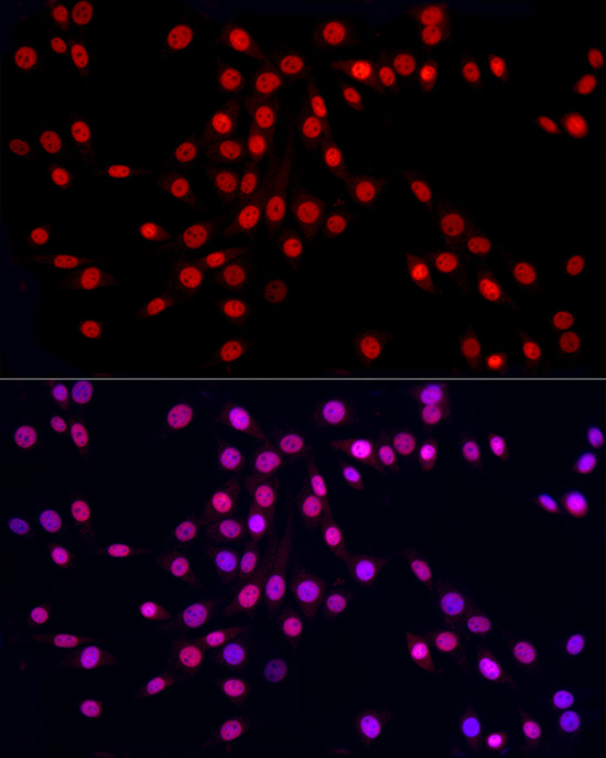 Immunofluorescence analysis of NIH/3T3 cells using HNRNPA2B1 Polyclonal Antibody at dilution of 1:50 (40x lens). Blue: DAPI for nuclear staining.