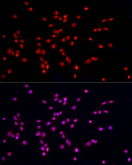 Immunofluorescence analysis of PC-12 cells using HNRNPA2B1 Polyclonal Antibody at dilution of 1:50 (40x lens). Blue: DAPI for nuclear staining.