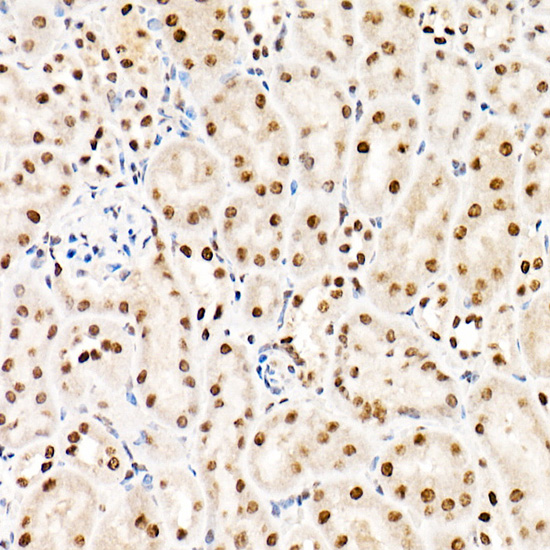 Immunohistochemistry of paraffin-embedded mouse kidney using [KO Validated] HNRNPA2B1 Polyclonal Antibody at dilution of 1:20 (40x lens).Perform high pressure antigen retrieval with 10 mM citrate buffer pH 6.0 before commencing with IHC staining protocol.