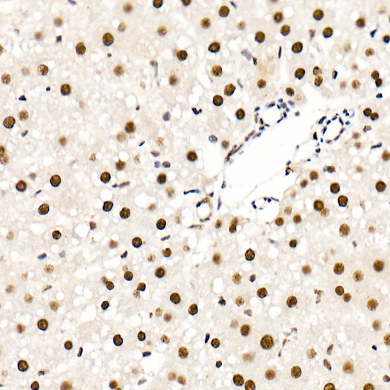 Immunohistochemistry of paraffin-embedded rat liver using [KO Validated] HNRNPA2B1 Polyclonal Antibody at dilution of 1:20 (40x lens).Perform high pressure antigen retrieval with 10 mM citrate buffer pH 6.0 before commencing with IHC staining protocol.