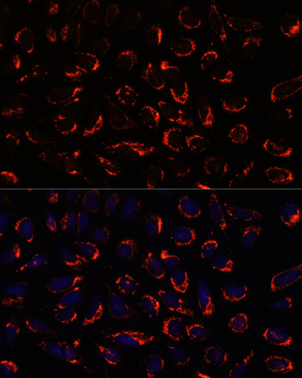 Immunofluorescence analysis of U2OS cells using SHMT2 Polyclonal Antibody at dilution of 1:100. Blue: DAPI for nuclear staining.