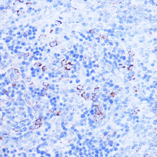 Immunohistochemistry of paraffin-embedded rat spleen using SHMT2 Polyclonal Antibody at dilution of 1:100 (40x lens).Perform microwave antigen retrieval with 10 mM PBS buffer pH 7.2 before commencing with IHC staining protocol.