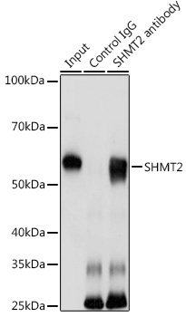 Immunoprecipitation analysis of 200ug extracts of HeLa cells using 3ug SHMT2 Polyclonal Antibody. Western blot was performed from the immunoprecipitate using SHMT2 Polyclonal Antibody at a dilution of 1:1000.