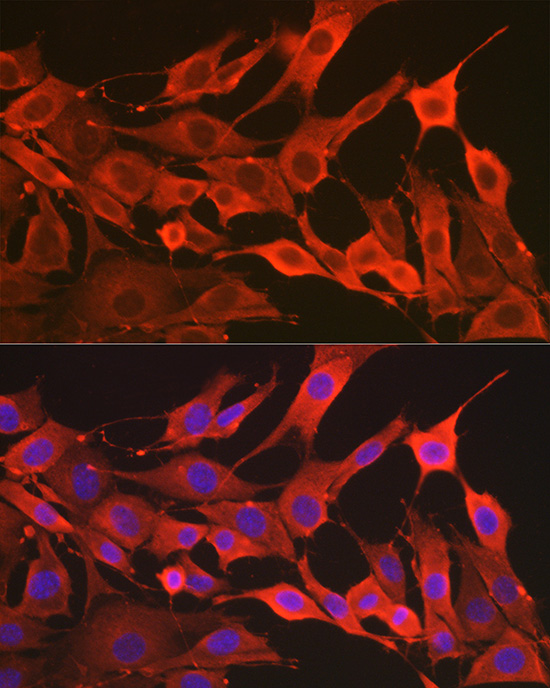 Immunofluorescence analysis of NIH/3T3 cells using [KO Validated] SOD2 Polyclonal Antibody at dilution of 1:50 (40x lens). Blue: DAPI for nuclear staining.