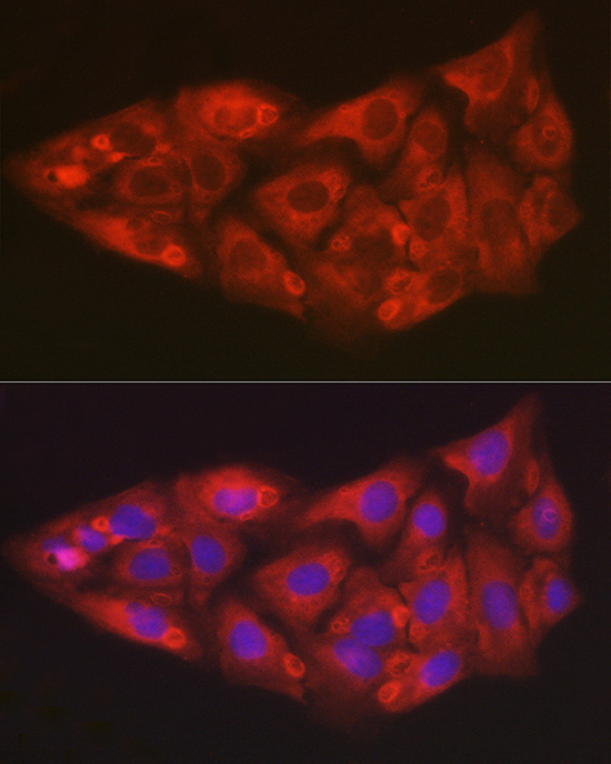 Immunofluorescence analysis of U2OS cells using [KO Validated] SOD2 Polyclonal Antibody at dilution of 1:50 (40x lens). Blue: DAPI for nuclear staining.