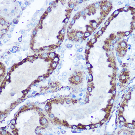 Immunohistochemistry of paraffin-embedded rat kidney using SOD2 Polyclonal Antibody at dilution of 1:100 (40x lens).Perform microwave antigen retrieval with 10 mM Tris/EDTA buffer pH 9.0 before commencing with IHC staining protocol.