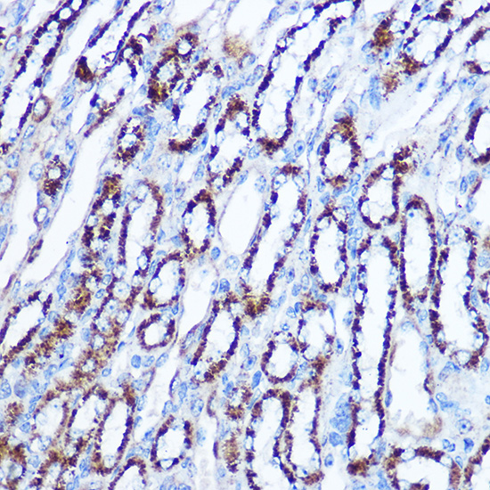 Immunohistochemistry of paraffin-embedded mouse kidney using SOD2 Polyclonal Antibody at dilution of 1:100 (40x lens).Perform microwave antigen retrieval with 10 mM Tris/EDTA buffer pH 9.0 before commencing with IHC staining protocol.